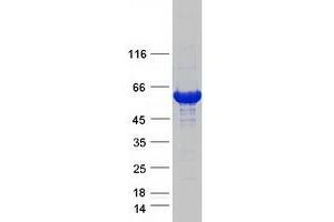 Western Blotting (WB) image for Formiminotransferase Cyclodeaminase (FTCD) (Transcript Variant B) protein (Myc-DYKDDDDK Tag) (ABIN2714240)