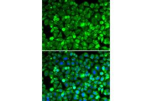Immunofluorescence analysis of HeLa cell using RPLP1 antibody. (RPLP1 Antikörper)