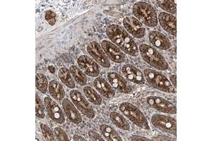 Immunohistochemical staining of human duodenum with UQCC polyclonal antibody  shows strong granular cytoplasmic positivity in glandular cells at 1:200-1:500 dilution. (Ubiquinol-Cytochrome C Reductase Complex Chaperone (UQCC) Antikörper)
