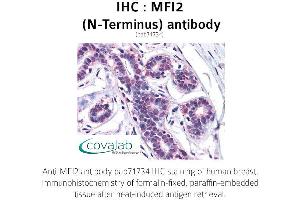 Image no. 1 for anti-Antigen P97 (Melanoma Associated) Identified By Monoclonal Antibodies 133.2 and 96.5 (MFI2) (N-Term) antibody (ABIN1736928) (MFI2 Antikörper  (N-Term))