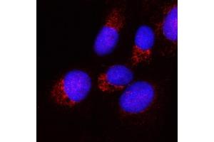 IF analysis of PPA2 using anti-PPA2 antibody (ABIN6719431).