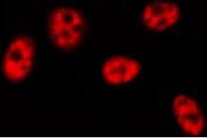 ABIN6274464 staining HeLa cells by IF/ICC. (BRF1 Antikörper  (Internal Region))