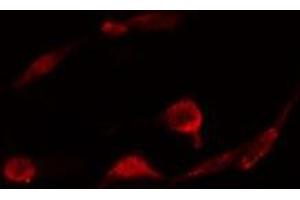 ABIN6278331 staining  A431 cells by IF/ICC.