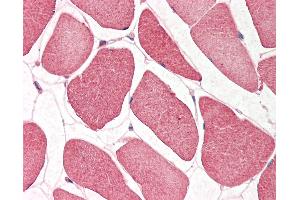 Human Skeletal Muscle: Formalin-Fixed, Paraffin-Embedded (FFPE). (NRF1 Antikörper  (N-Term))