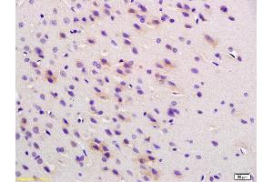 Formalin-fixed and paraffin embedded rat brain labeled with Anti Phospho-Cofilin (Ser3) Polyclonal Antibody , Unconjugated at 1:200, followed by conjugation to the secondary antibody and DAB staining (Cofilin Antikörper  (pSer3))
