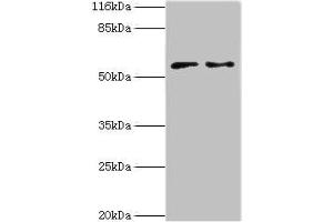 Western blot All lanes: CRISPLD2 antibody at 2 μg/mL Lane 1: Jurkat whole cell lysate Lane 2: CEM whole cell lysate Secondary Goat polyclonal to rabbit IgG at 1/10000 dilution Predicted band size: 56, 52, 43, 18, 14 kDa Observed band size: 56 kDa (CRISPLD2 Antikörper  (AA 40-305))
