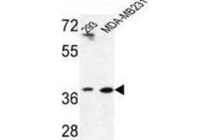 Western Blotting (WB) image for anti-Methionine Adenosyltransferase II, beta (MAT2B) antibody (ABIN3004219) (MAT2B Antikörper)