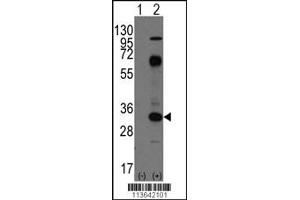 Western blot analysis of CD8A using rabbit polyclonal CD8A Antibody using 293 cell lysates (2 ug/lane) either nontransfected (Lane 1) or transiently transfected with the CD8A gene (Lane 2).