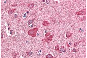Human Brain, Cortex (formalin-fixed, paraffin-embedded) stained with PITPNM3 antibody ABIN337021 at 5 ug/ml followed by biotinylated anti-goat IgG secondary antibody ABIN481715, alkaline phosphatase-streptavidin and chromogen. (NIR1 Antikörper  (AA 962-974))
