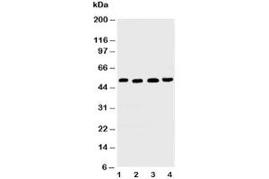 Western blot testing of TRAIL R2 antibody and Lane 1:  HeLa (TNFRSF10B Antikörper  (C-Term))