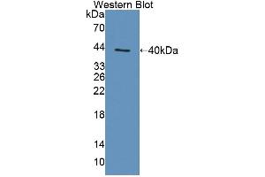 Western Blotting (WB) image for anti-Transporter 1, ATP-Binding Cassette, Sub-Family B (MDR/TAP) (TAP1) (AA 525-808) antibody (ABIN1871341)