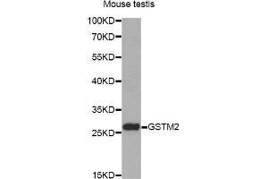 Western blot analysis of extracts of mouse testis, using GSTM2 antibody (ABIN6292965) at 1:1000 dilution.
