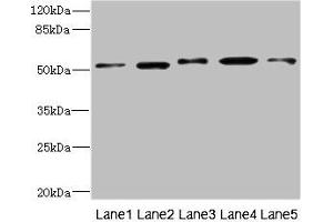 Western blot All lanes: NFKBIE antibody at 4. (NFKBIE Antikörper  (AA 140-280))