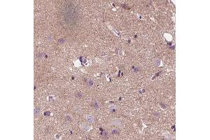 ABIN6266852 at 1/100 staining human brain tissue sections by IHC-P. (APC Antikörper  (Internal Region))