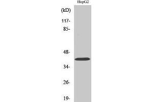 Western Blotting (WB) image for anti-Ribosomal Modification Protein RimK-Like Family Member B (RIMKLB) (Internal Region) antibody (ABIN3175055) (RIMKLB Antikörper  (Internal Region))