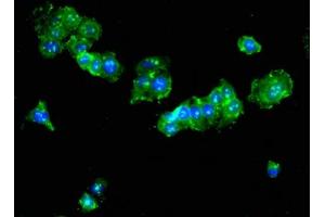 Immunofluorescent analysis of HepG2 cells using ABIN7173992 at dilution of 1:100 and Alexa Fluor 488-congugated AffiniPure Goat Anti-Rabbit IgG(H+L) (Tat (AA 25-111) Antikörper)