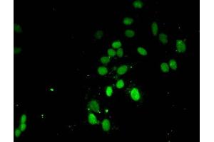 Immunofluorescent analysis of Hela cells using ABIN7139671 at dilution of 1:100 and Alexa Fluor 488-congugated AffiniPure Goat Anti-Rabbit IgG(H+L) (HIST1H3A Antikörper  (3meLys4))