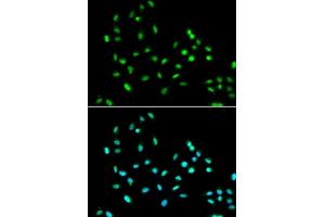 Immunofluorescence analysis of  cells using SM antibody (ABIN6131360, ABIN6148103, ABIN6148105 and ABIN6221551). (SMARCAD1 Antikörper  (AA 1-300))