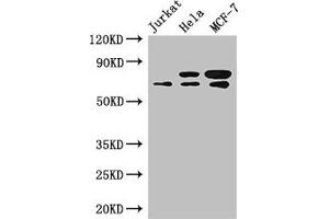Western Blot Positive WB detected in: Jurkat whole cell lysate, Hela whole cell lysate, MCF-7 whole cell lysate All lanes: INTS9 antibody at 3. (INTS9 Antikörper  (AA 368-658))