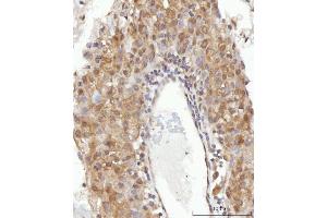 anti-Centrosomal Protein 250kDa (CEP250) (AA 563-853) antibody