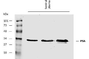 Western Blotting (WB) image for anti-Prostate Specific Antigen (PSA) antibody (ABIN94459)