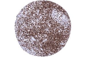 Tonsil Strong CD5 positivity of T lymphocytes interfollicular and in germinal centres (Rekombinanter CD5 Antikörper  (AA 32-372))