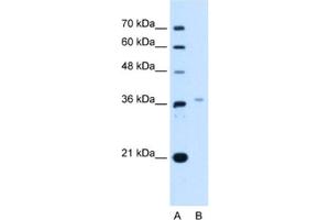 Western Blotting (WB) image for anti-LIM Homeobox 8 (LHX8) antibody (ABIN2463069) (LHX8 Antikörper)