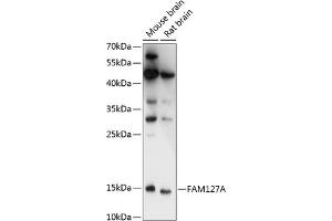 Western blot analysis of extracts of various cell lines, using FA antibody (ABIN7267106) at 1:3000 dilution. (CXX1 Antikörper  (AA 1-113))