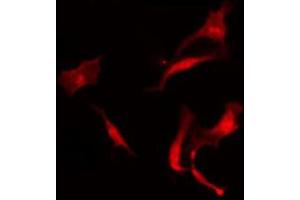 ABIN6273923 staining A549 by IF/ICC. (CCKBR Antikörper  (N-Term))