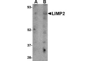 Western Blotting (WB) image for anti-Scavenger Receptor Class B, Member 2 (SCARB2) (C-Term) antibody (ABIN1030483) (SCARB2 Antikörper  (C-Term))