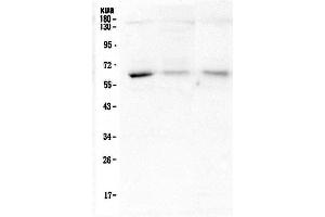 Western blot analysis of ARSA using anti-ARSA antibody (ABIN5692787). (Arylsulfatase A Antikörper  (C-Term))
