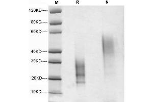 5 μg of IL-13, Human was resolved with SDS-PAGE under reducing (R) and non-reducing (N) conditions and visualized by Coomassie Blue staining.