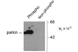 Western blots of HEK293 cells transfected with Parkin WT (Phospho) and Parkin S101 mutant (non-phospho) showing the phospho-specific immunolabeling of the ~ 52 k parkin protein. (Parkin Antikörper  (pSer101))