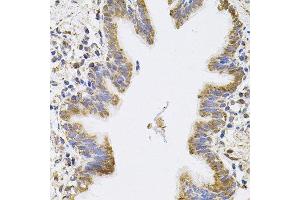 Immunohistochemistry of paraffin-embedded human lung using SPR antibody. (SPR Antikörper)