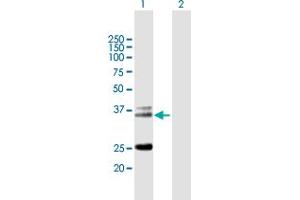 Western Blot analysis of TRA@ expression in transfected 293T cell line by TRA@ MaxPab polyclonal antibody. (TCR alpha Antikörper  (AA 1-278))
