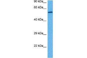 Host:  Rabbit  Target Name:  GLUD1  Sample Tissue:  Rat Skeletal Muscle  Antibody Dilution:  1ug/ml