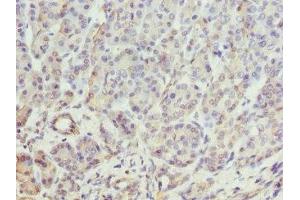 Immunohistochemistry of paraffin-embedded human pancreatic tissue using ABIN7145897 at dilution of 1:100 (BTNL2 Antikörper  (AA 246-455))