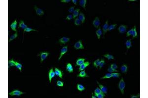 Immunofluorescence (IF) image for anti-Major Histocompatibility Complex, Class II, DR beta 1 (HLA-DRB1) (AA 30-266) antibody (ABIN7155613)