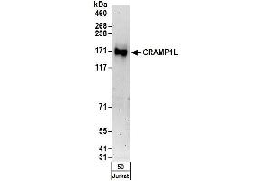 anti-Crm, Cramped-Like (CRAMP1L) (AA 1050-1100) antibody