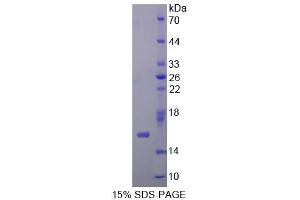 Image no. 1 for C-Myc Binding Protein (MYCBP) (AA 2-103) protein (His tag) (ABIN4990713) (MYCBP Protein (AA 2-103) (His tag))