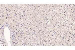 Immunohistochemistry (IHC) image for anti-Procollagen III N-Terminal Propeptide (PIIINP) antibody (ABIN7428533)