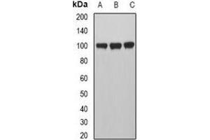 Western blot analysis of MVP expression in A549 (A), Hela (B), HepG2 (C) whole cell lysates. (MVP Antikörper)