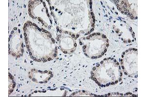 Image no. 3 for anti-Aminoacylase 1 (ACY1) antibody (ABIN1496454) (Aminoacylase 1 Antikörper)