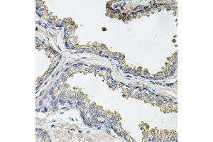 Immunohistochemistry of paraffin-embedded human prostate using ACO1 antibody (ABIN5995389) at dilution of 1/100 (40x lens).