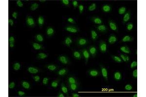Immunofluorescence (IF) image for anti-B-Cell CLL/lymphoma 9 (BCL9) (AA 1036-1135) antibody (ABIN560046)
