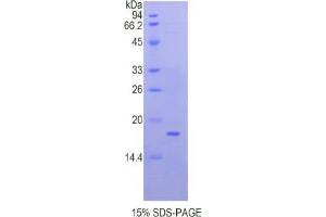 SDS-PAGE analysis of Human QSOX1 Protein. (QSOX1 Protein)