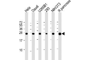 All lanes : Anti-RPL10 Antibody (N-term) at 1:2000 dilution Lane 1: Hela whole cell lysate Lane 2: Daudi whole cell lysate Lane 3: U266B1 whole cell lysate Lane 4: 293 whole cell lysate Lane 5: NIH/3T3 whole cell lysate Lane 6: Rat pancreas lysate Lysates/proteins at 20 μg per lane. (RPL10 Antikörper  (N-Term))