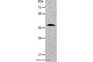 Western blot analysis of 293T cell, using PARD6A Polyclonal Antibody at dilution of 1:700 (PARD6A Antikörper)