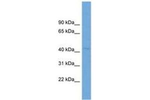 Image no. 1 for anti-Rab9 Effector Protein with Kelch Motifs (RABEPK) (AA 35-84) antibody (ABIN6744934) (RABEPK Antikörper  (AA 35-84))