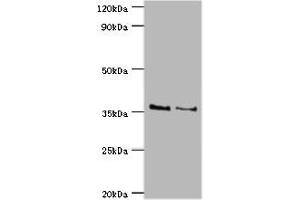Western blot All lanes: HOXA1 antibody at 2 μg/mL Lane 1: NIH/3T3 whole cell lysate Lane 2: Hela whole cell lysate Secondary Goat polyclonal to rabbit IgG at 1/10000 dilution Predicted band size: 37, 15, 25 kDa Observed band size: 37 kDa (HOXA1 Antikörper  (AA 75-205))